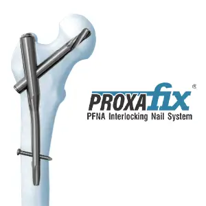 Proxafix — Proximal Femoral Fixation Implants