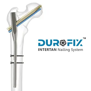 Durofix — Durable Fixation Implant System