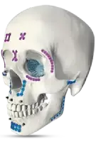 Maxillofacial Implants — Titanium Plates and Screws for Craniomaxillofacial Surgery